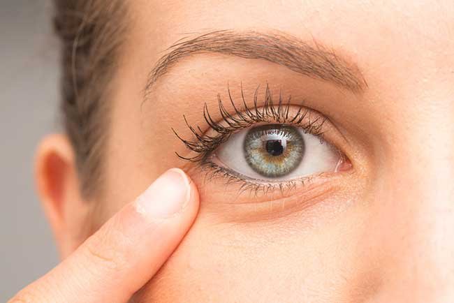 Home Remedies for Black Eye