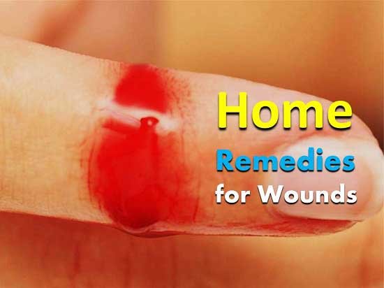 Home Remedies for Wounds